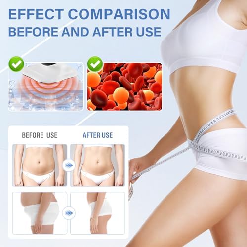 Masseur Anti-cellulite Manuel - Pour Drainage Lymphatique Et Raffermissement Des Jambes